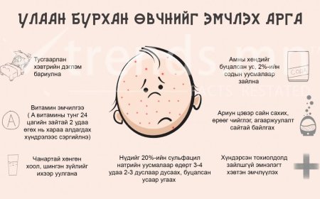 Улаан бурхан өвчин